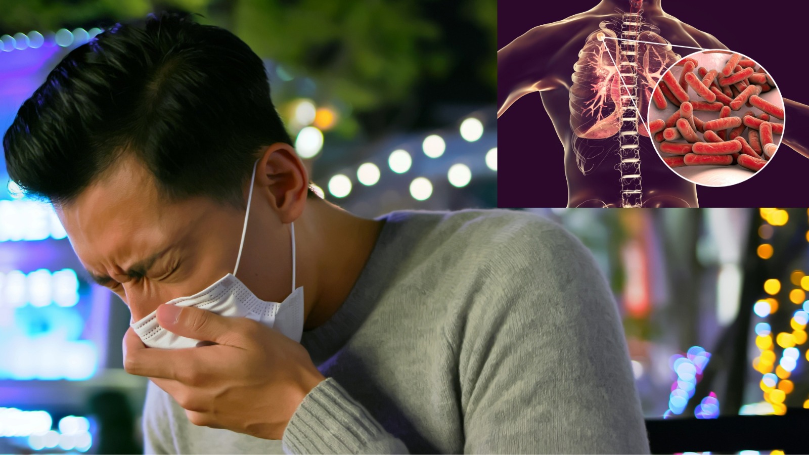 revolutionizing_tuberculosis_detecion